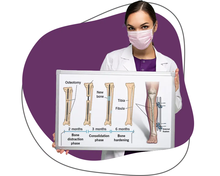 تطويل القامة بعد البلوغ عملية تطويل القامة